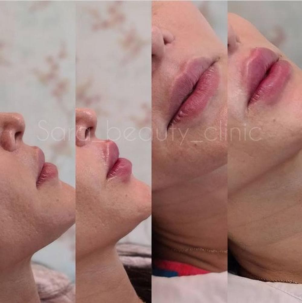 place کلینیک پوست مو و زیبایی دکتر امیرحسین یوسفی و دکتر فیروزه عسگری