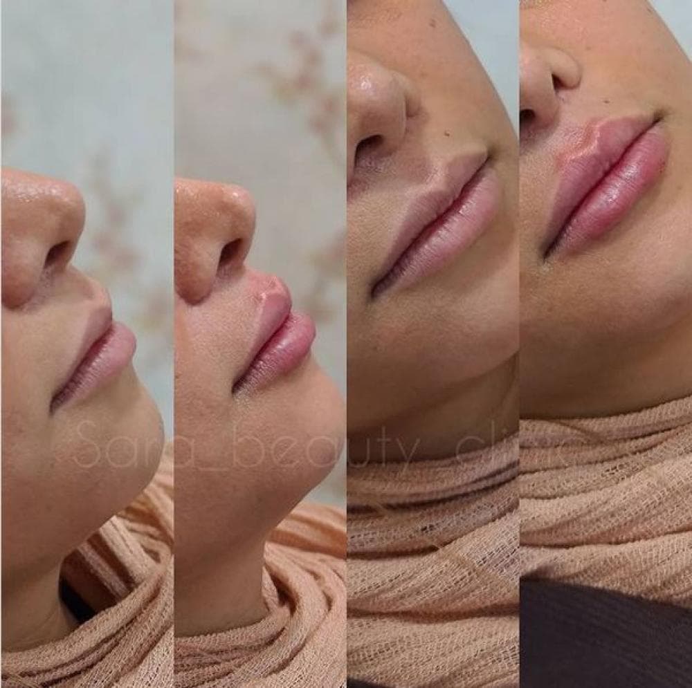 place کلینیک پوست مو و زیبایی دکتر امیرحسین یوسفی و دکتر فیروزه عسگری