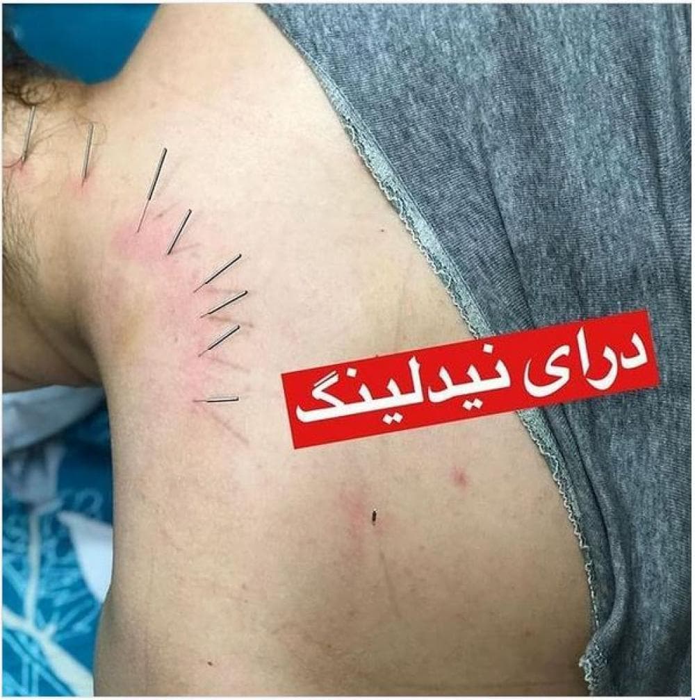 place مرکز تخصصی فیزیوتراپی پردیس